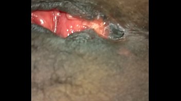 میری چربی کی گود کو پھیلا دیں اور اسے تیز کر دیں